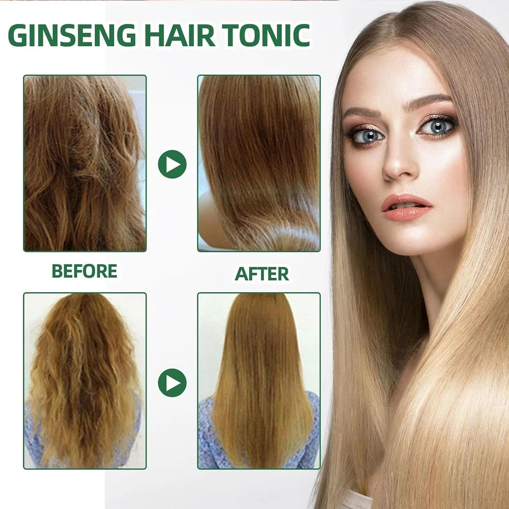 Spray Nutritivo de Ginseng para Crecimiento Capilar